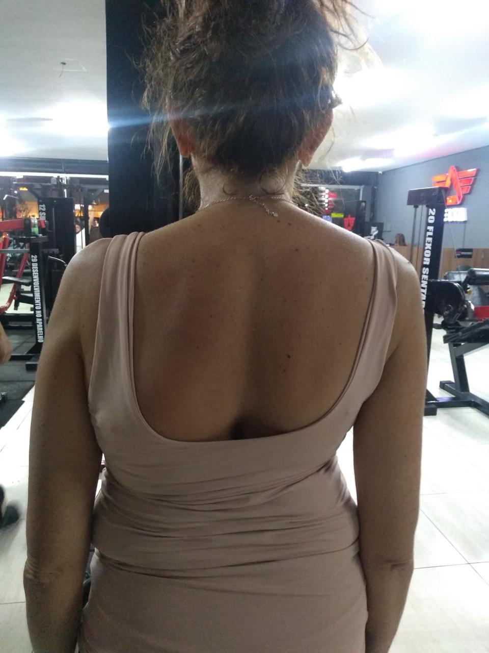 Sandra no início do acompanhamento