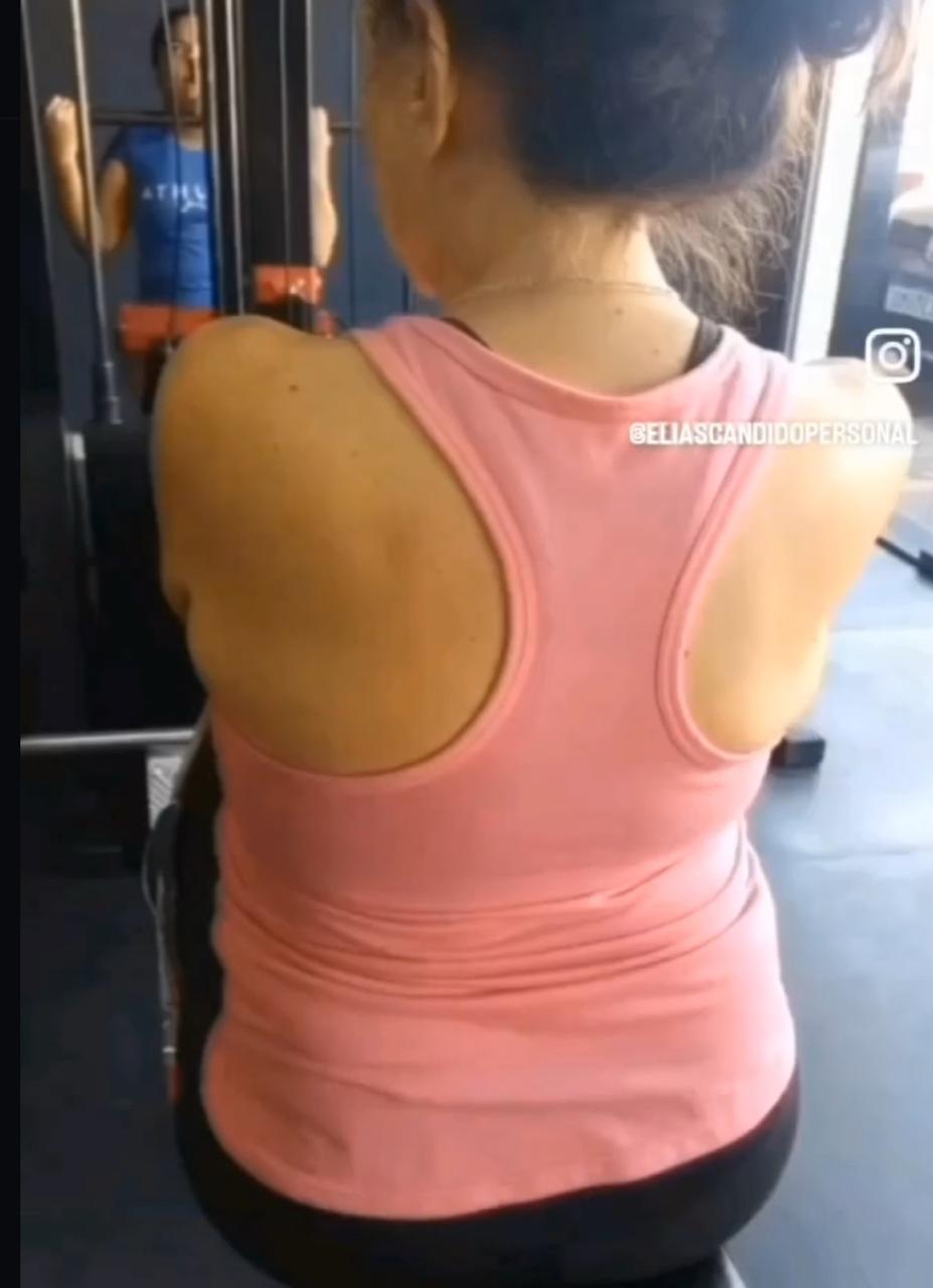 Evolução de Sandra após três meses
